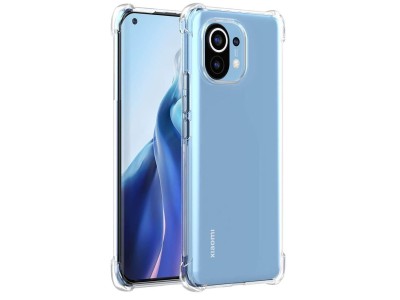 Evelatus Xiaomi Mi 11 Military Shockproof