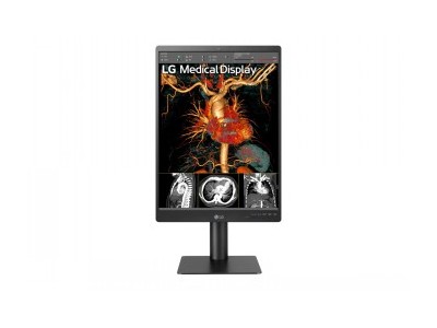 LG 21.3`` 3MP IPS DIAGNOSTIC